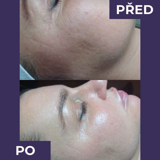 Skin Touch Ruce - Lifting efekt