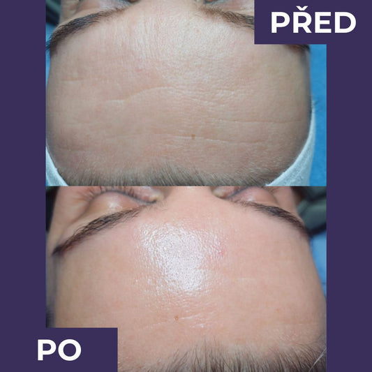 Skin Touch Ruce - Lifting efekt